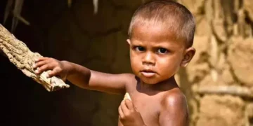 Increase in the number of malnourished children, UNICEF issued an alert