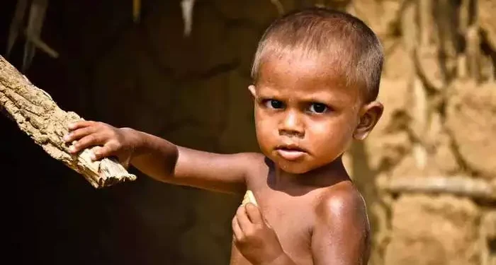 Increase in the number of malnourished children, UNICEF issued an alert