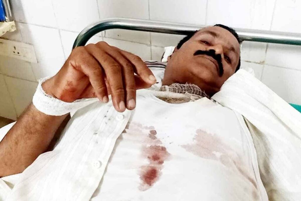 Jharkhand BJP leader Amleshwar Kumar Dubey brothers Manoj Kumar Dubey, Dinesh Kumar Dubey, Akhileshwar Dubey, Ayush Kumar Dubey attacked with bow and arrow in a land dispute